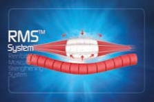 RMS system
